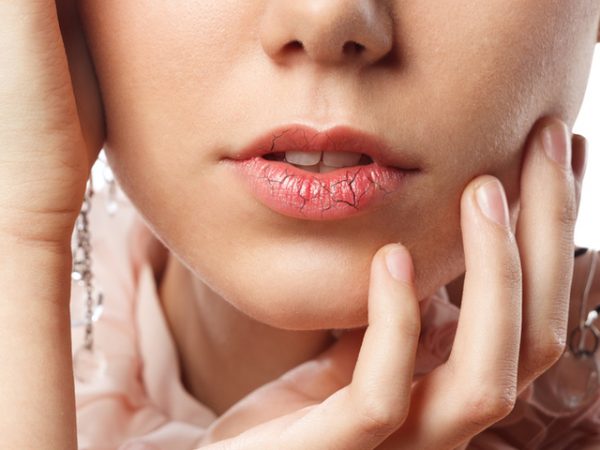 Как да защитим устните си от сухота и напукване