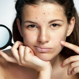 Помощ при проблемна кожа на лицето