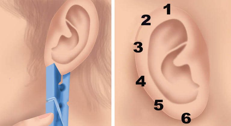 Сложете на ухото си щипка за 20 секунди – резултатът ще ви изненада!