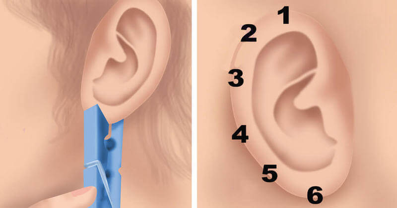 Сложете на ухото си щипка за 20 секунди - резултатът ще ви изненада!