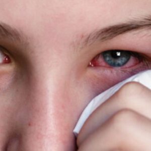 Домашни методи и рецепти при възпаления на очите