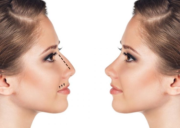 Как да контурирате правилно носа си
