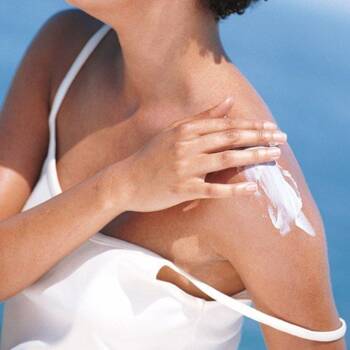  слънчево изгаряне 